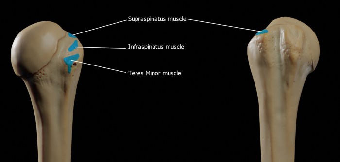 On to which structure does the highlighted muscle insert