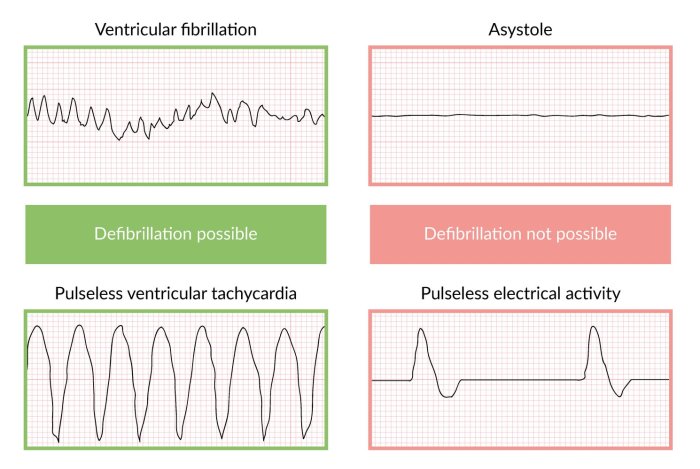 All cardiac arrest situations are shockable by an aed.